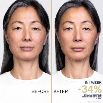 Shiseido Vital Perfection LiftDefine Radiance Night Concentrate ser de noapte cu efect lifting - imagine 3